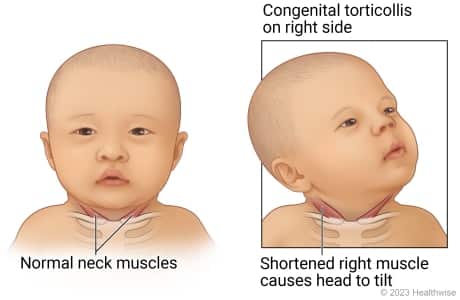 How and When To Start Tummy Time